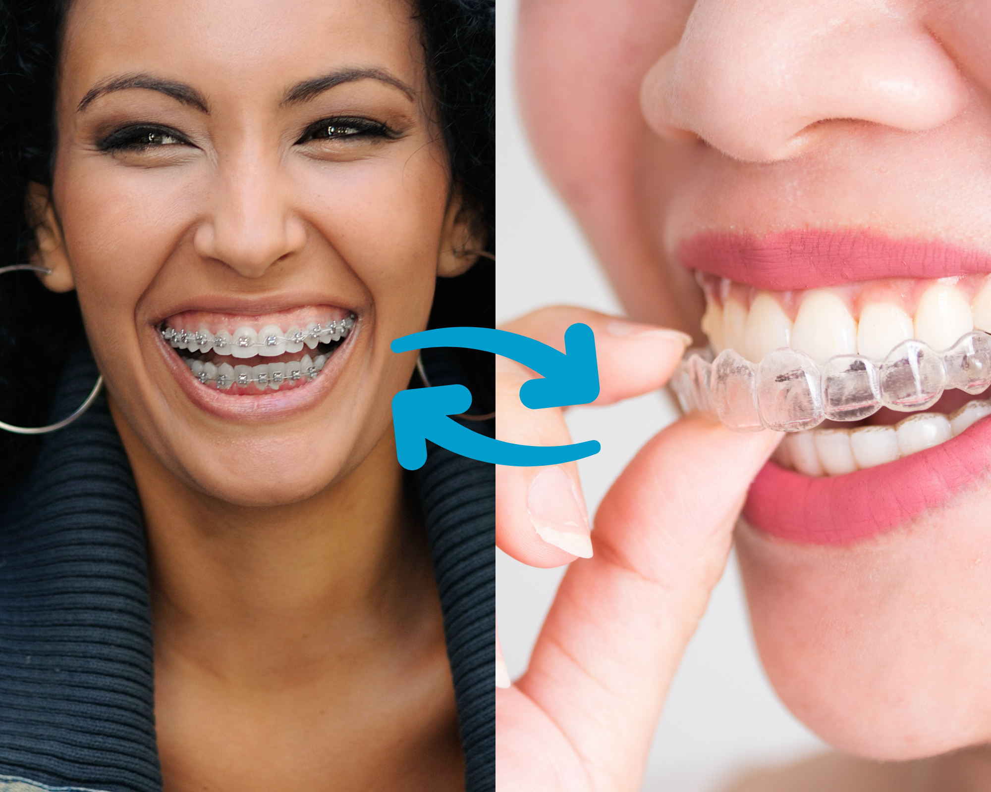 Can I Switch from Braces to Invisalign (or Vice Versa) Mid-Treatment? 1 Switching Braces Invisalign Blog Cover
