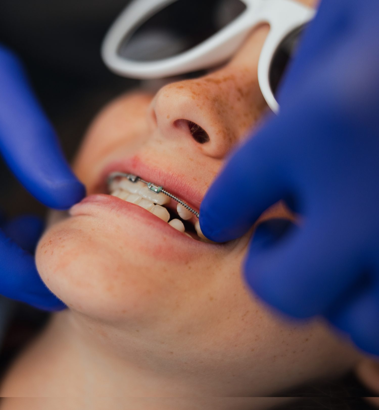 mccomb-orthodontics-braces-los-angeles
