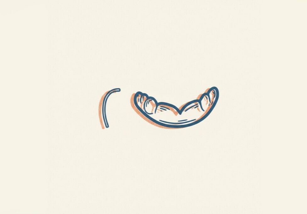 Editorial illustration for the McComb Orthodontics blog post: Fixed Retainers vs. Vivera: What’s Best for Keeping Your Smile Straight?